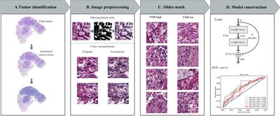 Predicting Tumor Mutational Burden From Lung Adenocarcinoma Histopathological Images Using Deep Learning